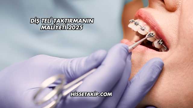 Diş Teli Taktırmanın Maliyeti 2025